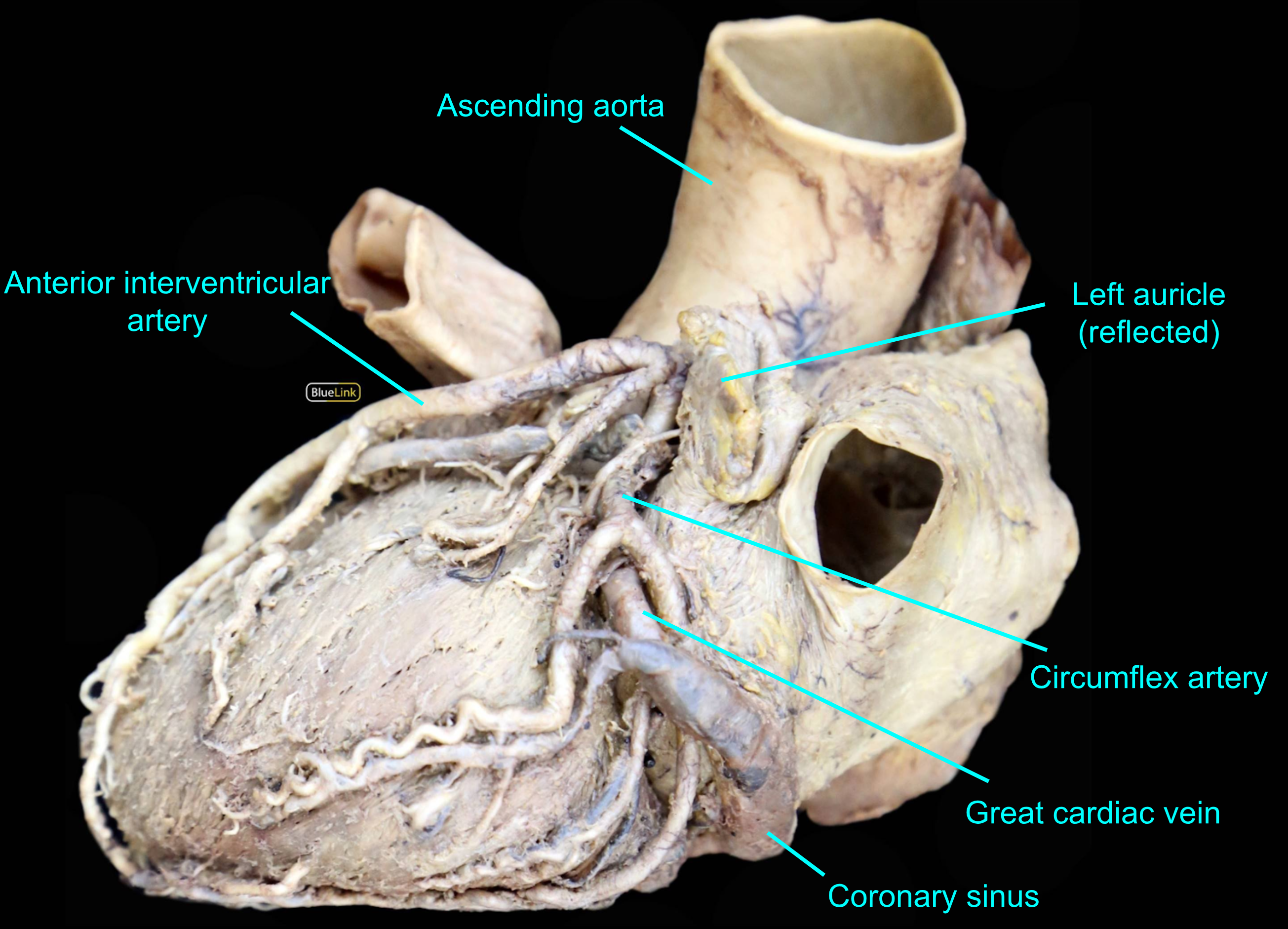 2.1 Thorax - Ross University Anatomy Instructional Site